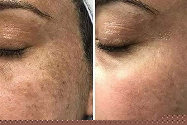 鍍鋅水管的價格/a_鍍鋅水管價格表